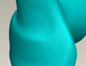 surfacing pro e